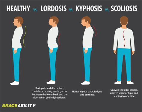 What is Kyphosis in Physical Education: Exploring the Curvature of the Spine and Its Implications